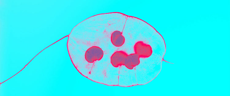 A Guide to Preimplantation Genetic Testing (PGT) and Its Role in IVF