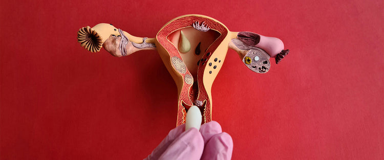 a uterus